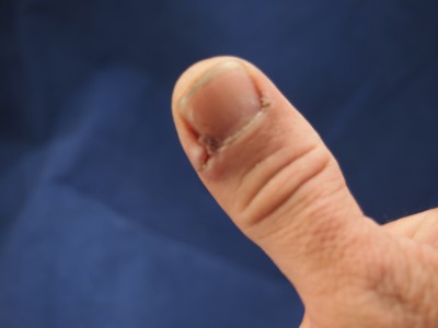 See my thumb? Gee I'm Dumb!