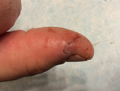 thumbouch.jpg