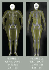 dxa-img.jpg