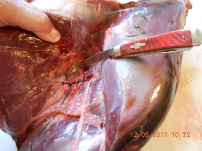 RR separating muscles