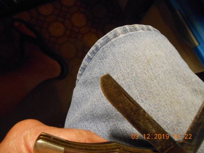 Broken tip on skinner blade