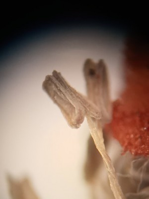 440 x magnification