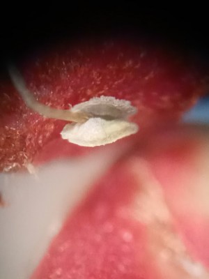 440 x mag. The pollen part.