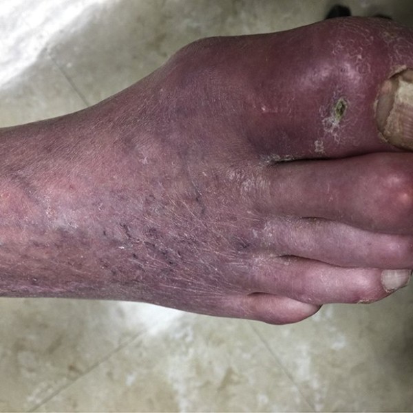 itchy-toe.jpg