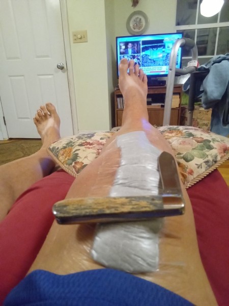 1000000441.jpg (130.45 KiB) Viewed 8408 times Bandage with knife from Glenn.